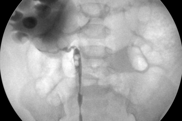 5b520634-5678-4ad2-8cc6-5cea25bbab96