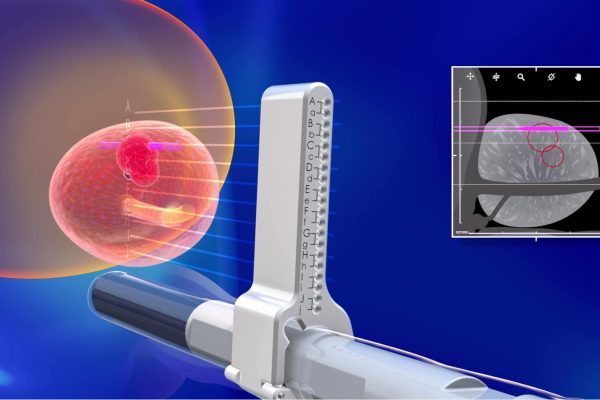 TRANSPERINEAL_VIRTUAL_BIOPSY_TRINITY