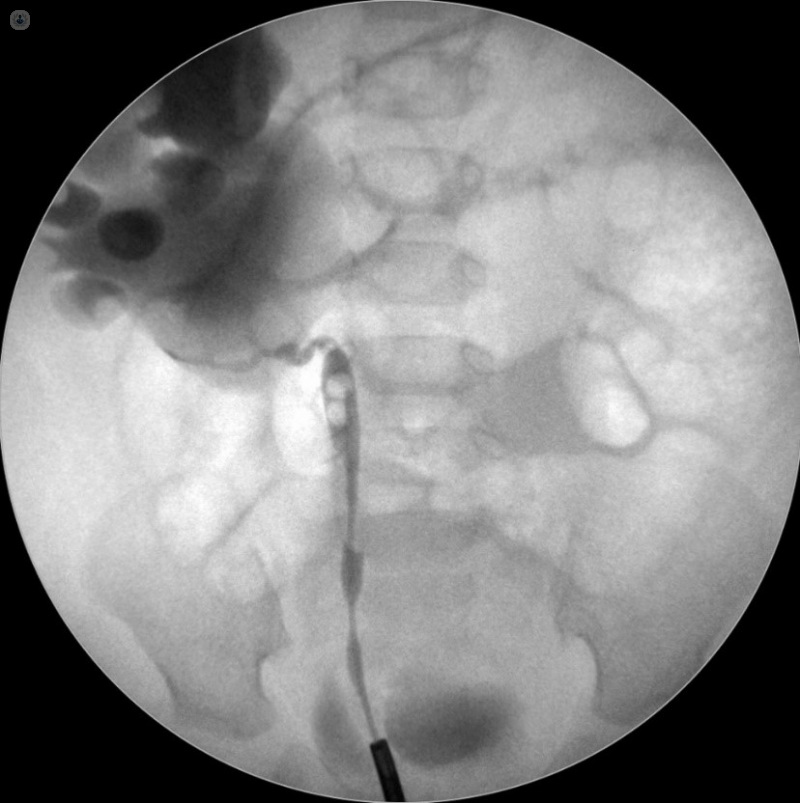 5b520634-5678-4ad2-8cc6-5cea25bbab96